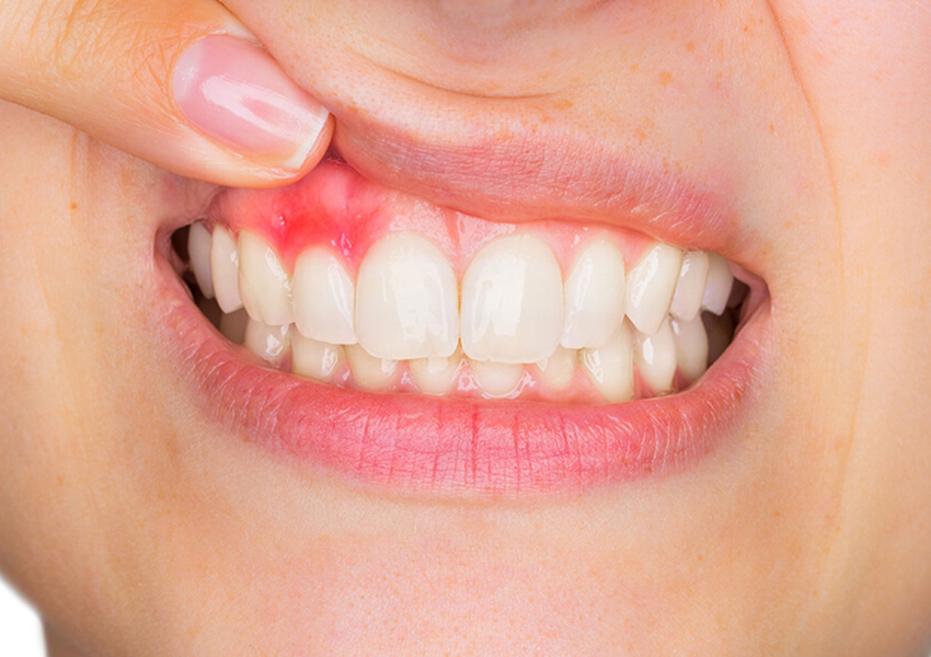 Periodontoloji